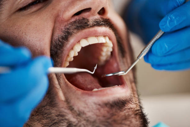 Best Emergency Denture Repair in Westmont, NJ